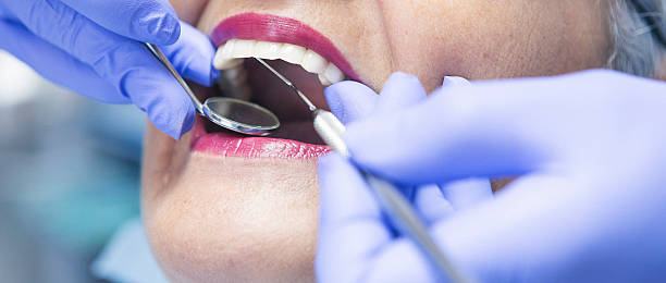 Best Emergency Treatment for Dental Infections or Abscesses in Parkwood, CA